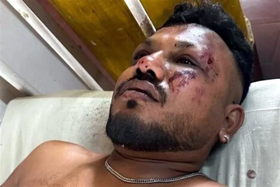 El jefe de la Policía de Ahmedabad, G.S. Malik, informó que la aeronave se estrelló contra un edificio residencial, complicando las labores de rescate.